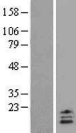 Novus Biologicals&trade;&nbsp;UCN2 Overexpression Lysate
