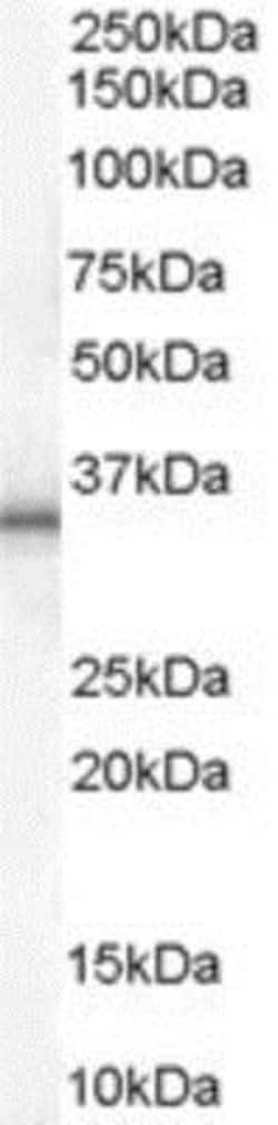 UCP1 Antibody, Novus Biologicals 0.1mg; Unlabeled:Antibodies, Polyclonal