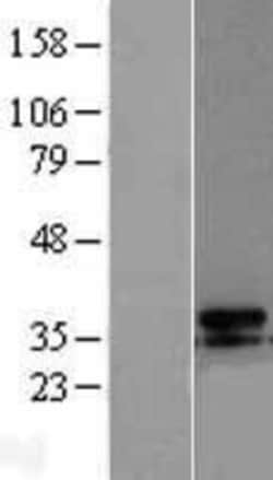Novus Biologicals™ UCP3 Overexpression Lysate