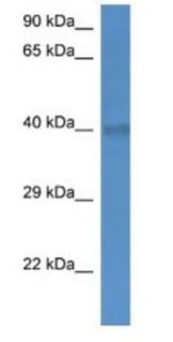 UCP4 Antibody, Novus Biologicals 100 &mu;L | Buy Online | Novus Biologicals | Fisher Scientific