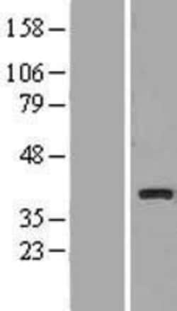 Novus Biologicals™ UCP4 Overexpression Lysate