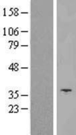 Novus Biologicals&trade;&nbsp;UCP5 Overexpression Lysate