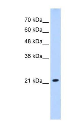 UCP5 Antibody, Novus Biologicals 0.1mg; Unlabeled:Antibodies, Polyclonal