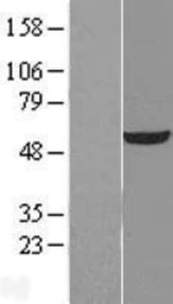 Novus Biologicals&trade;&nbsp;UDP glucose dehydrogenase Overexpression Lysate