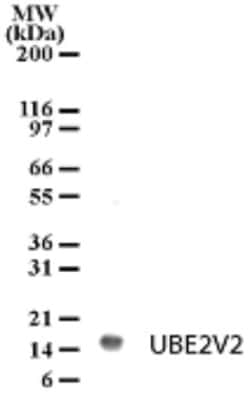 UEV2 Antibody, Novus Biologicals 0.1mg; Unlabeled:Antibodies, Polyclonal