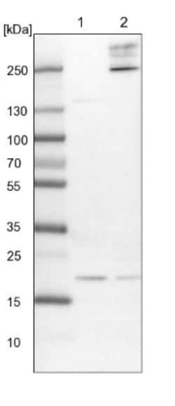 Ufc1 Antibody, Novus Biologicals 0.1mL; Unlabeled:Antibodies, Polyclonal