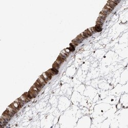 Ufc1 Antibody, Novus Biologicals 0.1 mL | Buy Online | Novus Biologicals | Fisher Scientific