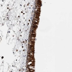 Ufc1 Antibody, Novus Biologicals 0.1mL; Unlabeled:Antibodies, Polyclonal