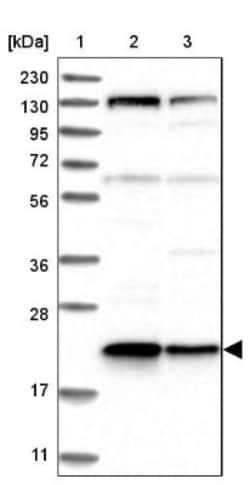 Ufc1 Antibody, Novus Biologicals 0.1 mL | Buy Online | Novus Biologicals | Fisher Scientific