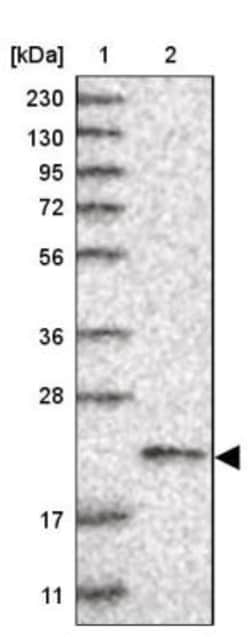 Ufc1 Antibody, Novus Biologicals 0.1mL; Unlabeled:Antibodies, Polyclonal