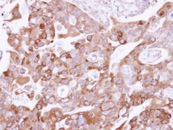 UFD1L Antibody, Novus Biologicals 0.1mL; Unlabeled:Antibodies, Polyclonal