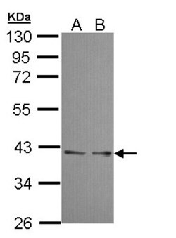 UFD1L Antibody, Novus Biologicals 0.1mL; Unlabeled:Antibodies, Polyclonal
