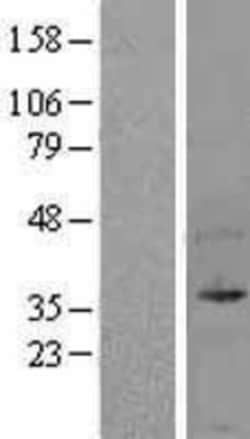 Novus Biologicals&trade;&nbsp;UFD1L Overexpression Lysate