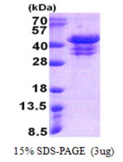 Novus Biologicals&trade;&nbsp;Recombinant Human UFD1L His Protein