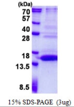 Novus Biologicals&trade;&nbsp;Recombinant Human UFSP1 His Protein