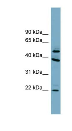 UFSP2 Antibody, Novus Biologicals 100&mu;L; Unlabeled:Antibodies, Polyclonal