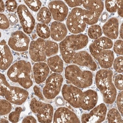 UGCG Antibody, Novus Biologicals 25 &mu;L | Buy Online | Novus Biologicals | Fisher Scientific