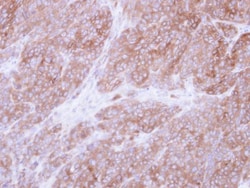 UGP2 Antibody, Novus Biologicals 0.1mL; Unlabeled:Antibodies, Polyclonal