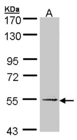UGP2 Antibody, Novus Biologicals 0.1mL; Unlabeled:Antibodies, Polyclonal