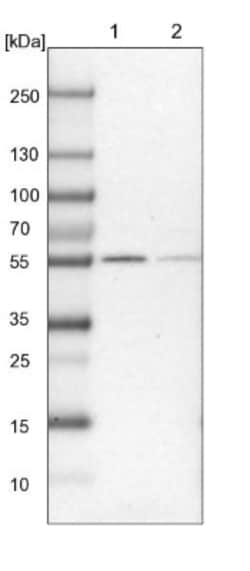 UGP2 Antibody, Novus Biologicals 0.1mL; Unlabeled:Antibodies, Polyclonal