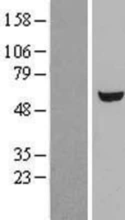 Novus Biologicals&trade;&nbsp;UGP2 Overexpression Lysate