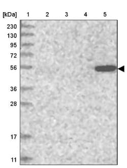 UGP2 Antibody, Novus Biologicals 0.1mL; Unlabeled:Antibodies, Polyclonal