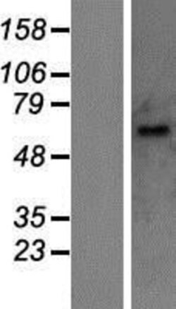 R&D Systems&trade;&nbsp;UGT1A10 Overexpression Lysate