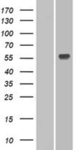 Novus Biologicals&trade;&nbsp;UGT1A3 Overexpression Lysate
