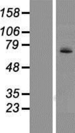 Novus Biologicals&trade;&nbsp;UGT1A4 Overexpression Lysate