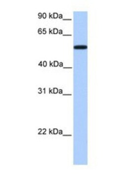 UGT2A3 Antibody, Novus Biologicals 0.05mg; Unlabeled:Antibodies, Polyclonal