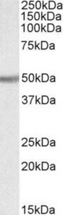 UGT2B Antibody, Novus Biologicals 0.1mg; Unlabeled:Antibodies, Polyclonal