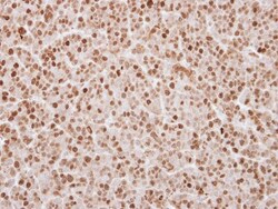 UHRF1 Antibody, Novus Biologicals 0.1mL; Unlabeled:Antibodies, Polyclonal