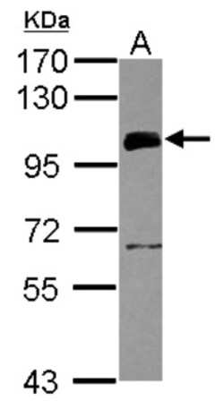 UHRF1 Antibody, Novus Biologicals 0.1mL; Unlabeled:Antibodies, Polyclonal