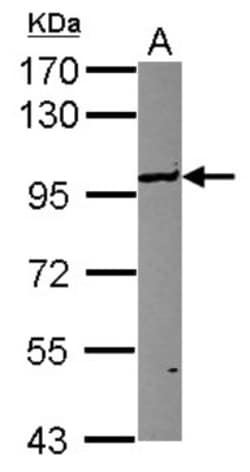 UHRF1 Antibody, Novus Biologicals 0.1mL; Unlabeled:Antibodies, Polyclonal