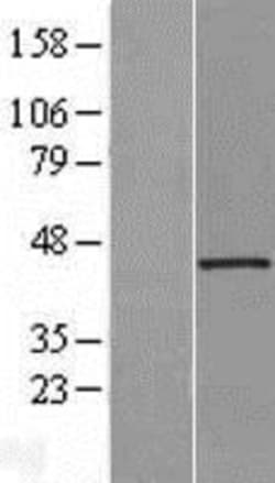 Novus Biologicals™ UIP1 Overexpression Lysate
