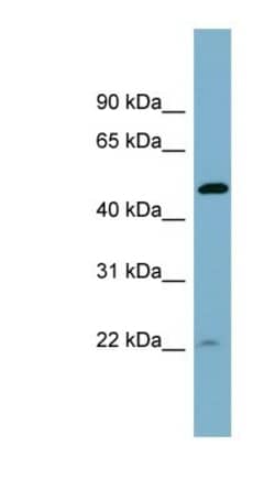 UIP1 Antibody, Novus Biologicals 100μL; Unlabeled:Antibodies, Polyclonal