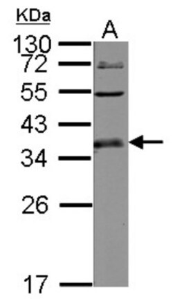 ULBP-1 Antibody, Novus Biologicals 0.1mL; Unlabeled:Antibodies, Polyclonal