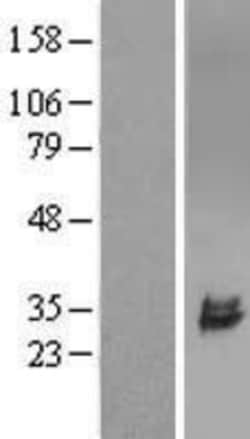 Novus Biologicals&trade;&nbsp;ULBP-2 Overexpression Lysate