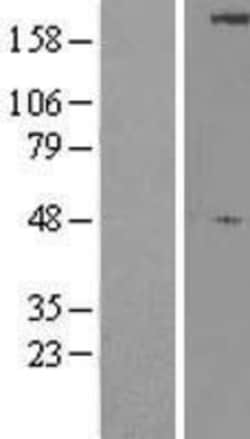 Novus Biologicals™ ULK1 Overexpression Lysate