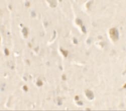 ULK1 Antibody - BSA Free, Novus Biologicals 0.025 mg, Unlabeled:Antibodies,