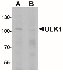 ULK1 Antibody - BSA Free, Novus Biologicals 0.025 mg, Unlabeled:Antibodies,