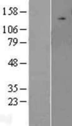 Novus Biologicals&trade;&nbsp;ULK2 Overexpression Lysate