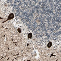 ULK2 Antibody, Novus Biologicals 0.1mL; Unlabeled:Antibodies, Polyclonal