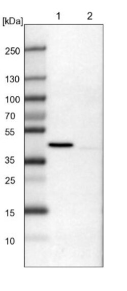 ULK3 Antibody, Novus Biologicals:Antibodies:Primary Antibodies