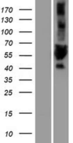 Novus Biologicals&trade;&nbsp;ULK3 Overexpression Lysate