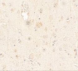 ULK3 Antibody - BSA Free, Novus Biologicals 0.025 mg, Unlabeled:Antibodies,