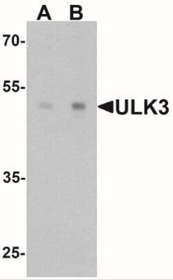 ULK3 Antibody - BSA Free, Novus Biologicals 0.025 mg, Unlabeled:Antibodies,