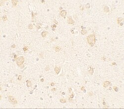 ULK4 Antibody - BSA Free, Novus Biologicals:Antibodies:Primary Antibodies