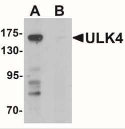ULK4 Antibody - BSA Free, Novus Biologicals:Antibodies:Primary Antibodies