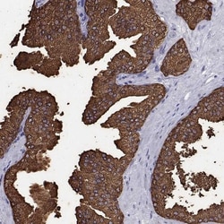 UMODL1 Antibody, Novus Biologicals 25 &mu;L, Unlabeled:Antibodies, Polyclonal